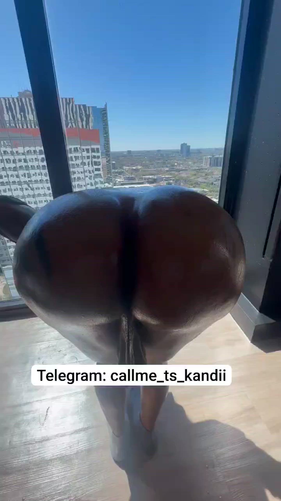 Trans Trans Boy Trans Man Trans Woman